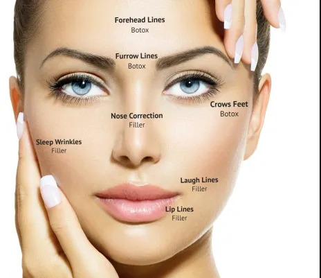 Botox procedure