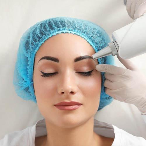 Eyebrow Laser Tattoo Removal