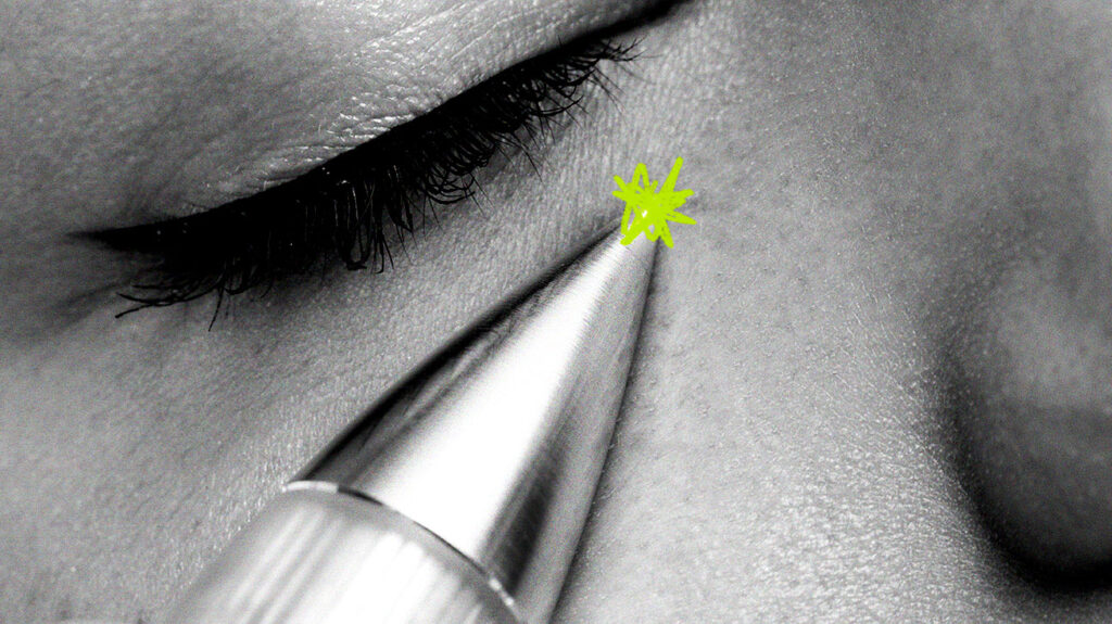 Fibroblast Plasma