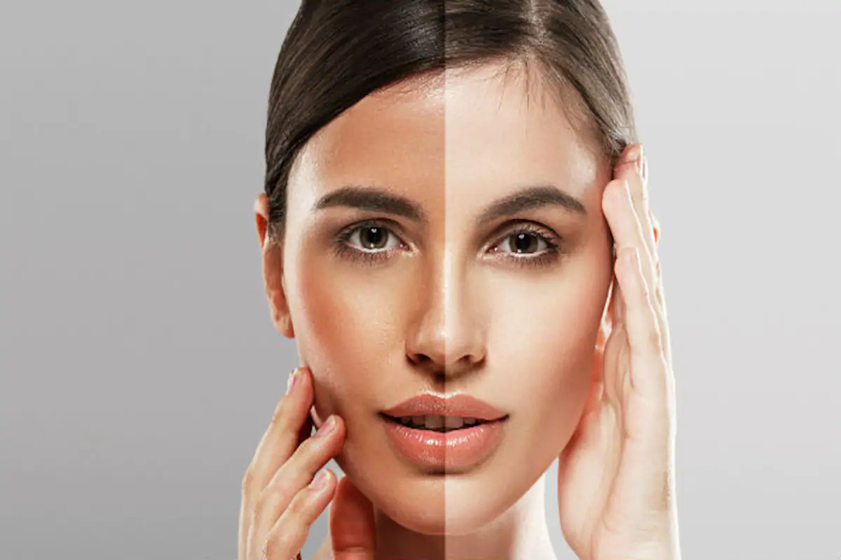 Skin Brightening