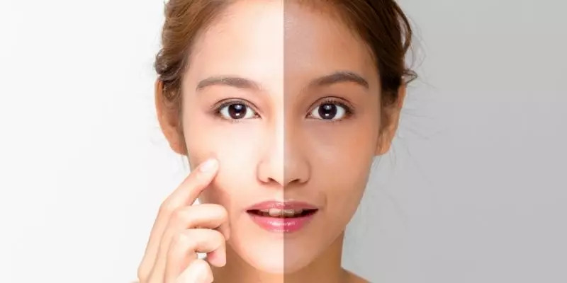 Skin Brightening & Lightening procedure